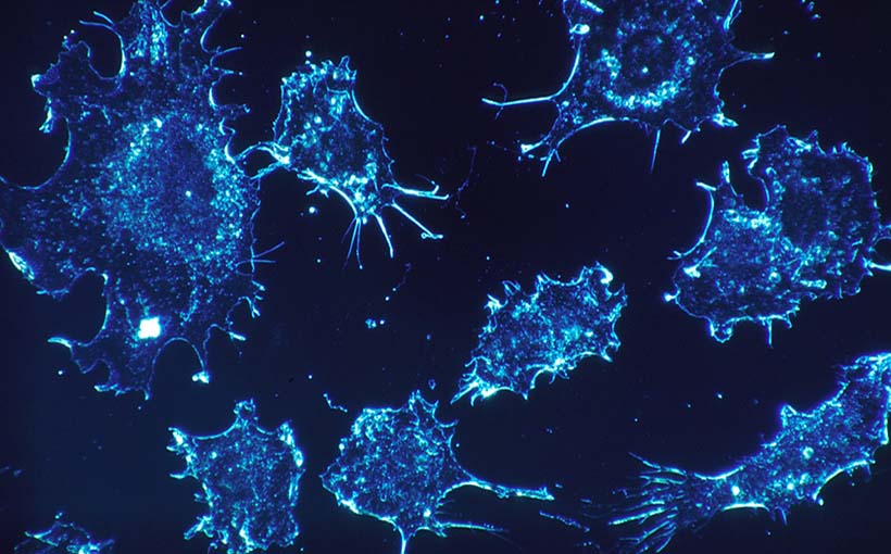 Next Oncology to Set Up in San Antonio